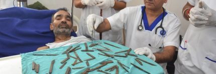 LO OPERANO PER UN TUMORE E GLI TROVANO 40 COLTELLI NELLO STOMACO