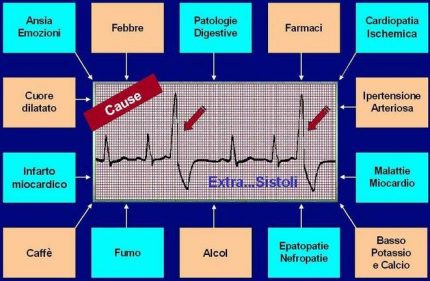 SINTOMO # 8: BATTITO CARDIACO INSTABILE