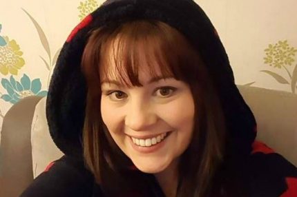 Vicki Hull è una donna di 29 anni e, fin dalla nascita, soffre di un grave disturbo chiamato lipodema che le causa la crescita del tessuto adiposo nella parte inferiore