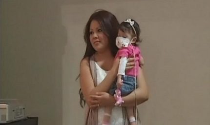 Pubblica le foto choc del fegato malato della figlia: “Tutti dovrebbero donare”