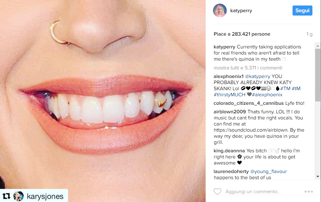 La figuraccia di Katy Perry: sul red carpet con qualcosa fra i denti
